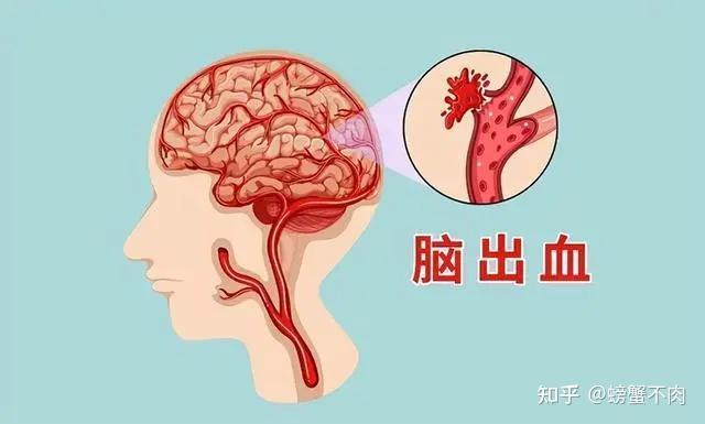 高血压的危害你注意了吗？