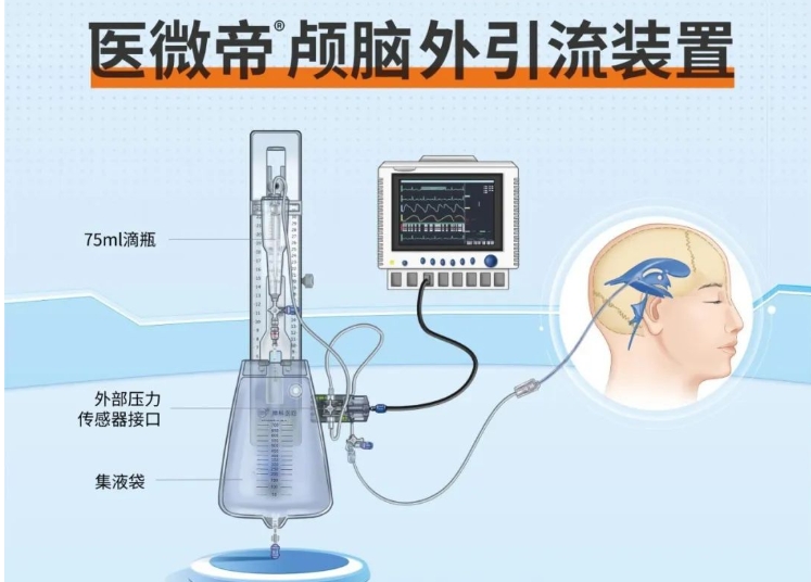 医微帝®产品介绍及颅脑外引流操作演示